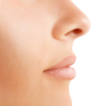 Rhinoplasty, Nose Surgery in Hungary, Budapest - SwissMedFlight