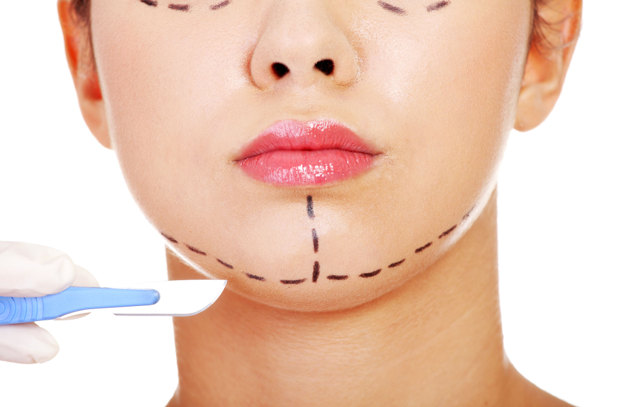 Genioplasty / Chin surgery in Hungary - SwissMedFlight