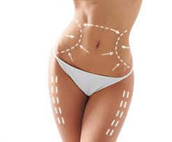 liposuction